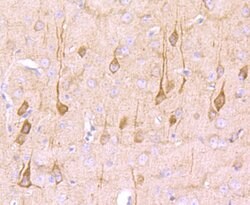 Neural/Glial Antigen 2 (NG2) Recombinant Rabbit Monoclonal Antibody (JM10-13):Antibodies,
