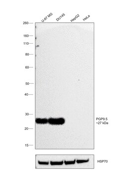 Invitrogen PGP9.5 Recombinant Rabbit Monoclonal Antibody (JM10-59) 100 &mu;L | Buy Online | Invitrogen&trade; | Fisher Scientific