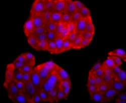 Invitrogen PGP9.5 Recombinant Rabbit Monoclonal Antibody (JM10-59) 100 &mu;L | Buy Online | Invitrogen&trade; | Fisher Scientific