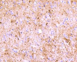 Invitrogen PGP9.5 Recombinant Rabbit Monoclonal Antibody (JM10-59) 100 &mu;L | Buy Online | Invitrogen&trade; | Fisher Scientific
