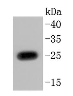 Invitrogen PGP9.5 Recombinant Rabbit Monoclonal Antibody (JM10-59) 100 &mu;L | Buy Online | Invitrogen&trade; | Fisher Scientific