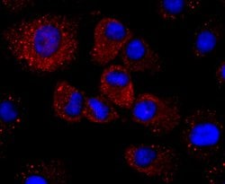 Invitrogen Haptoglobin Recombinant Rabbit Monoclonal Antibody (JM10-79)