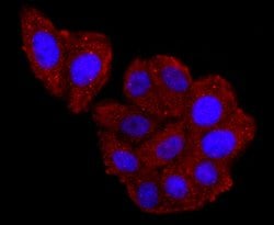 Invitrogen Haptoglobin Recombinant Rabbit Monoclonal Antibody (JM10-79)