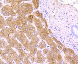 Invitrogen Haptoglobin Recombinant Rabbit Monoclonal Antibody (JM10-79)