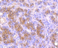 Invitrogen Urokinase Recombinant Rabbit Monoclonal Antibody (JM106-09)