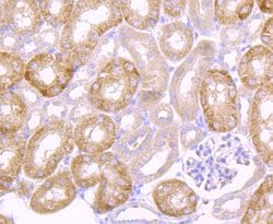 Invitrogen Urokinase Recombinant Rabbit Monoclonal Antibody (JM106-09)