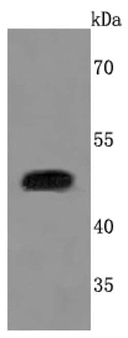 Invitrogen Urokinase Recombinant Rabbit Monoclonal Antibody (JM106-09)