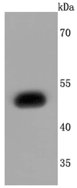 Invitrogen S1P1 Recombinant Rabbit Monoclonal Antibody (JM10-66) 100 &mu;L;