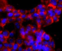 Invitrogen ATP Synthase beta Recombinant Rabbit Monoclonal Antibody (JM10-90)