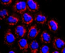 Invitrogen ATP Synthase beta Recombinant Rabbit Monoclonal Antibody (JM10-90)