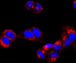 Invitrogen ATP Synthase beta Recombinant Rabbit Monoclonal Antibody (JM10-90)