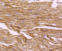 Invitrogen ATP Synthase beta Recombinant Rabbit Monoclonal Antibody (JM10-90)