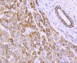 Invitrogen ATP Synthase beta Recombinant Rabbit Monoclonal Antibody (JM10-90)