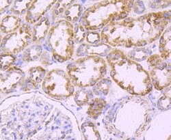 Invitrogen ATP Synthase beta Recombinant Rabbit Monoclonal Antibody (JM10-90)