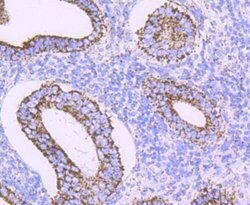 Invitrogen ATP Synthase beta Recombinant Rabbit Monoclonal Antibody (JM10-90)
