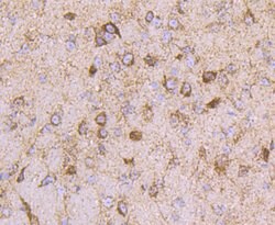 Invitrogen ATP Synthase beta Recombinant Rabbit Monoclonal Antibody (JM10-90)