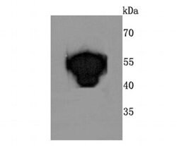 Invitrogen ATP Synthase beta Recombinant Rabbit Monoclonal Antibody (JM10-90)