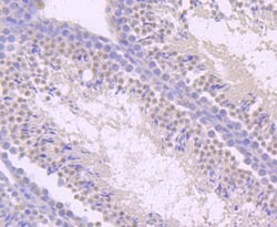 Invitrogen TLR5 Recombinant Rabbit Monoclonal Antibody (JM10-88) 100 &mu;L;