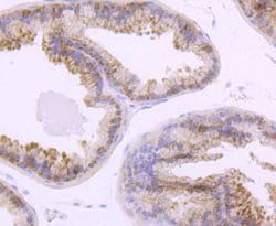 Invitrogen TLR5 Recombinant Rabbit Monoclonal Antibody (JM10-88) 100 &mu;L;