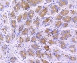 Invitrogen TLR5 Recombinant Rabbit Monoclonal Antibody (JM10-88) 100 &mu;L;