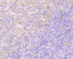 Invitrogen TLR5 Recombinant Rabbit Monoclonal Antibody (JM10-88) 100 &mu;L;