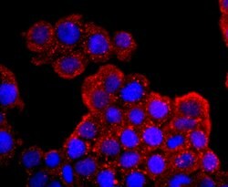 Invitrogen Aquaporin 1 Recombinant Rabbit Monoclonal Antibody (JM10-98)