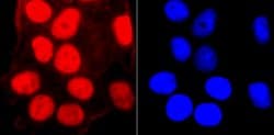 SMC3 Recombinant Rabbit Monoclonal Antibody (JM10-75):Antibodies, Recombinant