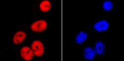 SMC3 Recombinant Rabbit Monoclonal Antibody (JM10-75):Antibodies, Recombinant