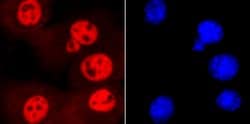 SMC3 Recombinant Rabbit Monoclonal Antibody (JM10-75):Antibodies, Recombinant