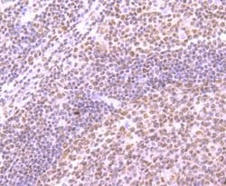 SMC3 Recombinant Rabbit Monoclonal Antibody (JM10-75):Antibodies, Recombinant