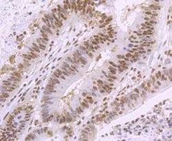 SMC3 Recombinant Rabbit Monoclonal Antibody (JM10-75):Antibodies, Recombinant