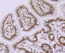 SMC3 Recombinant Rabbit Monoclonal Antibody (JM10-75):Antibodies, Recombinant