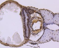 SMC3 Recombinant Rabbit Monoclonal Antibody (JM10-75):Antibodies, Recombinant