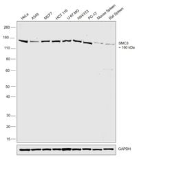 SMC3 Recombinant Rabbit Monoclonal Antibody (JM10-75):Antibodies, Recombinant