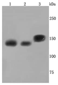 SMC3 Recombinant Rabbit Monoclonal Antibody (JM10-75):Antibodies, Recombinant