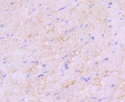 Invitrogen SDHA Recombinant Rabbit Monoclonal Antibody (JM10-83) 100 &mu;L;