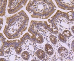 Invitrogen SDHA Recombinant Rabbit Monoclonal Antibody (JM10-83) 100 &mu;L;