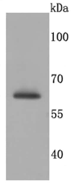 Invitrogen SDHA Recombinant Rabbit Monoclonal Antibody (JM10-83) 100 &mu;L;