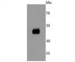 Invitrogen CD32 Recombinant Rabbit Monoclonal Antibody (JM10-70) 100 &mu;L;