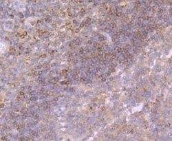 Invitrogen Growth Hormone Recombinant Rabbit Monoclonal Antibody (JM108-09)
