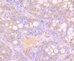 Invitrogen Growth Hormone Recombinant Rabbit Monoclonal Antibody (JM108-09)