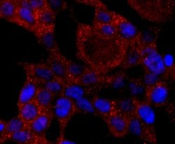 Invitrogen CYP2E1 Recombinant Rabbit Monoclonal Antibody (JM10-85) 100