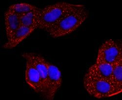 Invitrogen CYP2E1 Recombinant Rabbit Monoclonal Antibody (JM10-85) 100