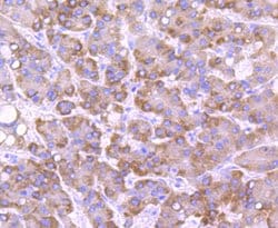 Invitrogen CYP2E1 Recombinant Rabbit Monoclonal Antibody (JM10-85) 100