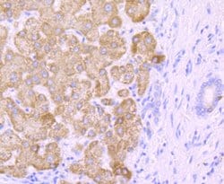 Invitrogen CYP2E1 Recombinant Rabbit Monoclonal Antibody (JM10-85) 100