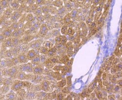 Invitrogen CYP2E1 Recombinant Rabbit Monoclonal Antibody (JM10-85) 100