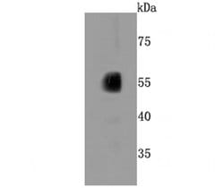 Invitrogen CYP2E1 Recombinant Rabbit Monoclonal Antibody (JM10-85) 100