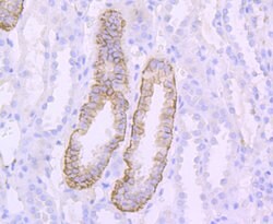 Invitrogen CD171 (L1CAM) Recombinant Rabbit Monoclonal Antibody (JM11-05)