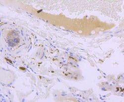 Invitrogen CD171 (L1CAM) Recombinant Rabbit Monoclonal Antibody (JM11-05)