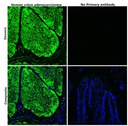 Invitrogen CD104 (Integrin beta 4) Recombinant Rabbit Monoclonal Antibody